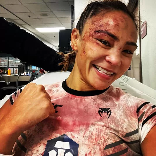 UFC woman fighter: Michelle Waterson-Gomez on Bloody TKO Aftermath